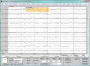 Signal Quality Check